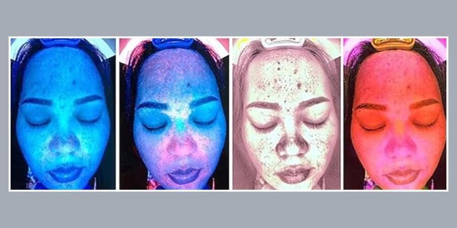 Varias imágenes piel