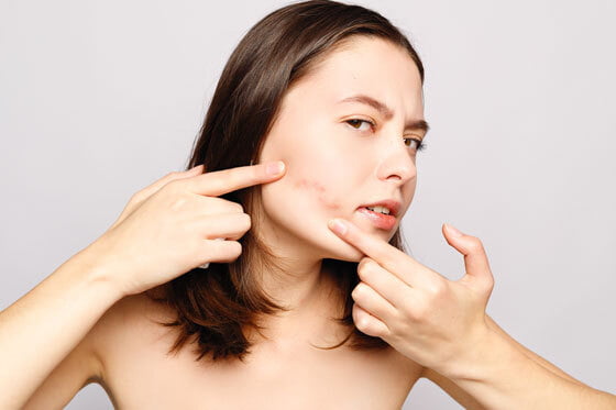 ¿Qué es la piel sensible? 5 claves que debes saber 