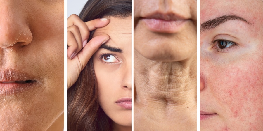 Tipos de piel y condiciones tratadas con ADN de salmón