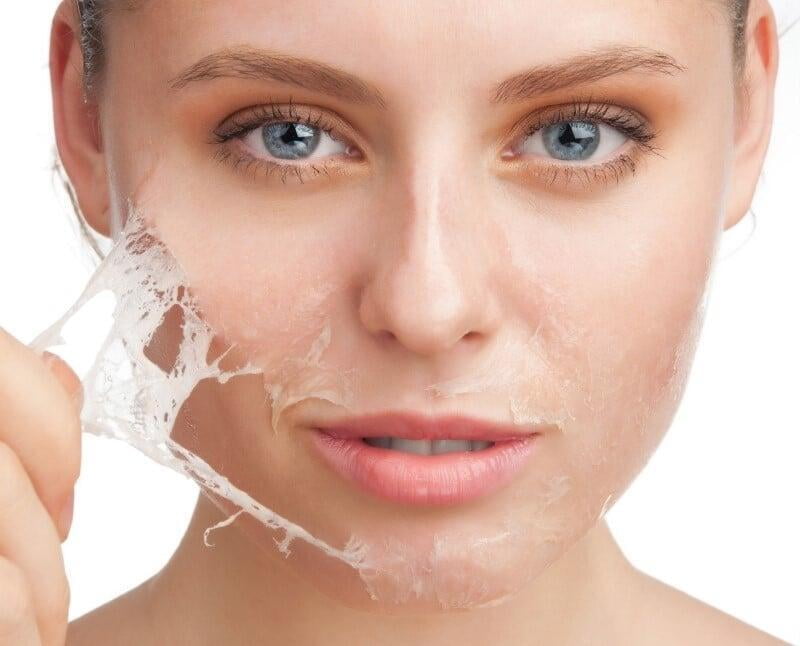 ¿Qué es un peeling facial y cuáles son sus beneficios para nuestra piel? 