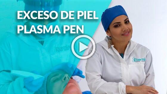 Blefaroplastia sin cirugia plasma pen